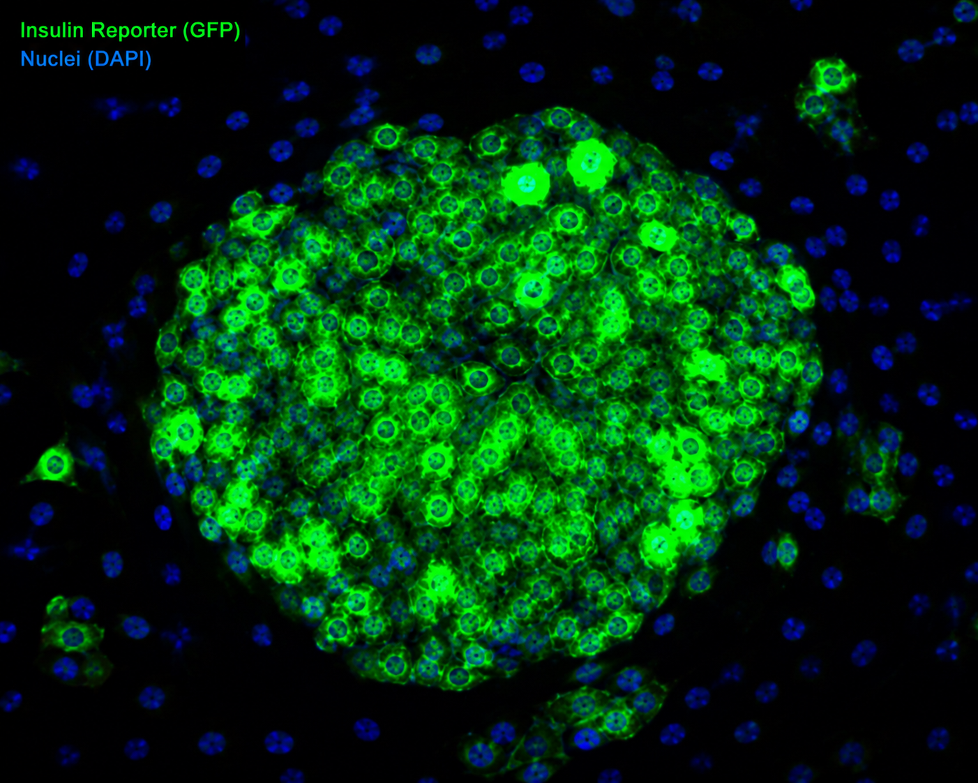 Human iPSC with Insulin Differentiation Reporter (GFP)