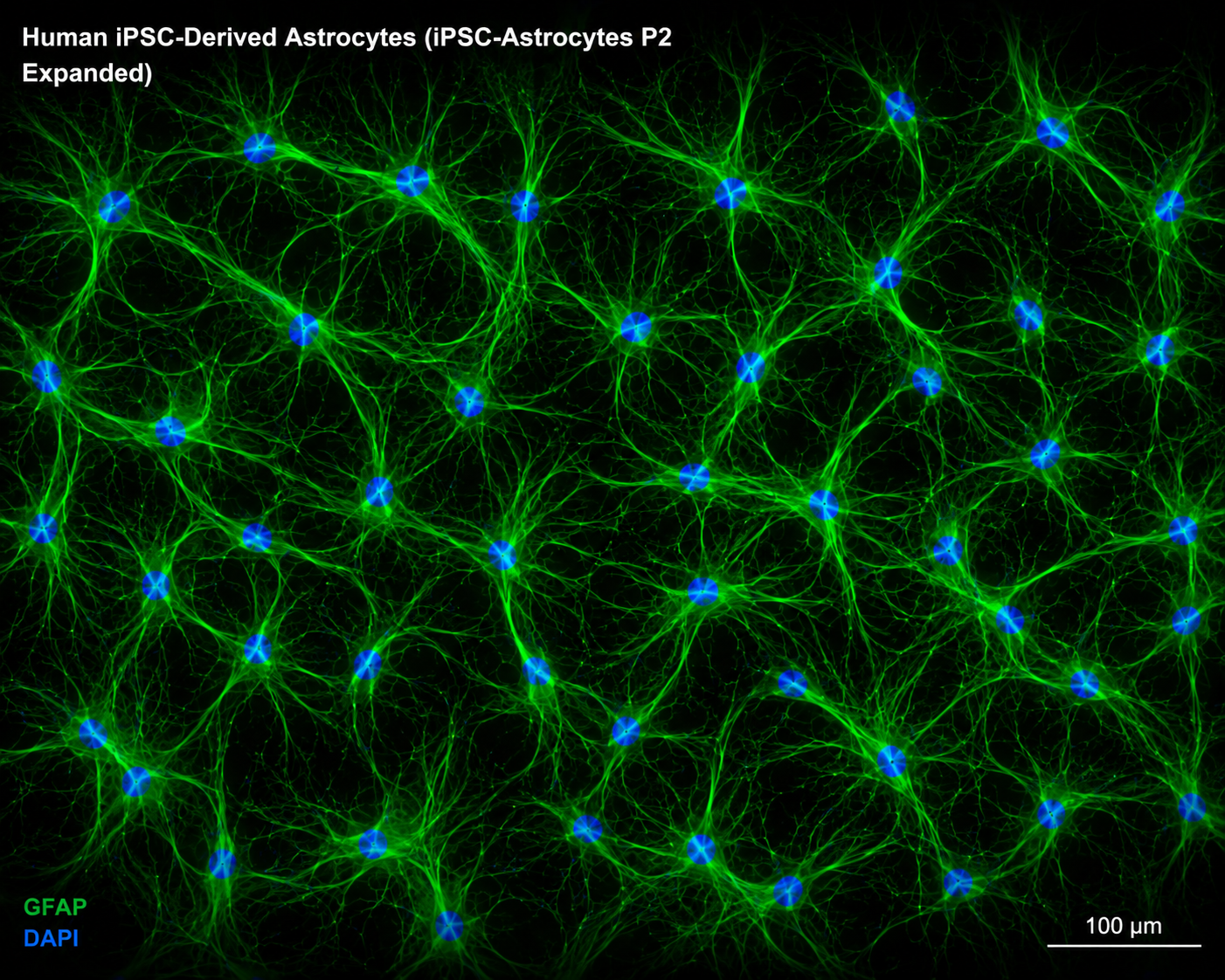Human iPSC-Derived Astrocytes (iPSC-Astrocytes P2 Expanded)