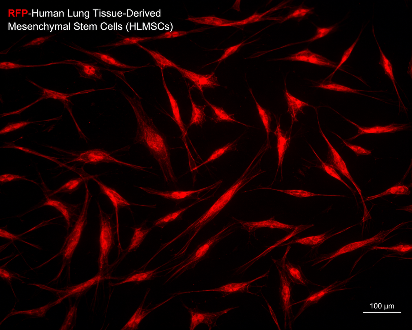 RFP-Human Lung Tissue-Derived Mesenchymal Stem Cells (HLMSCs)