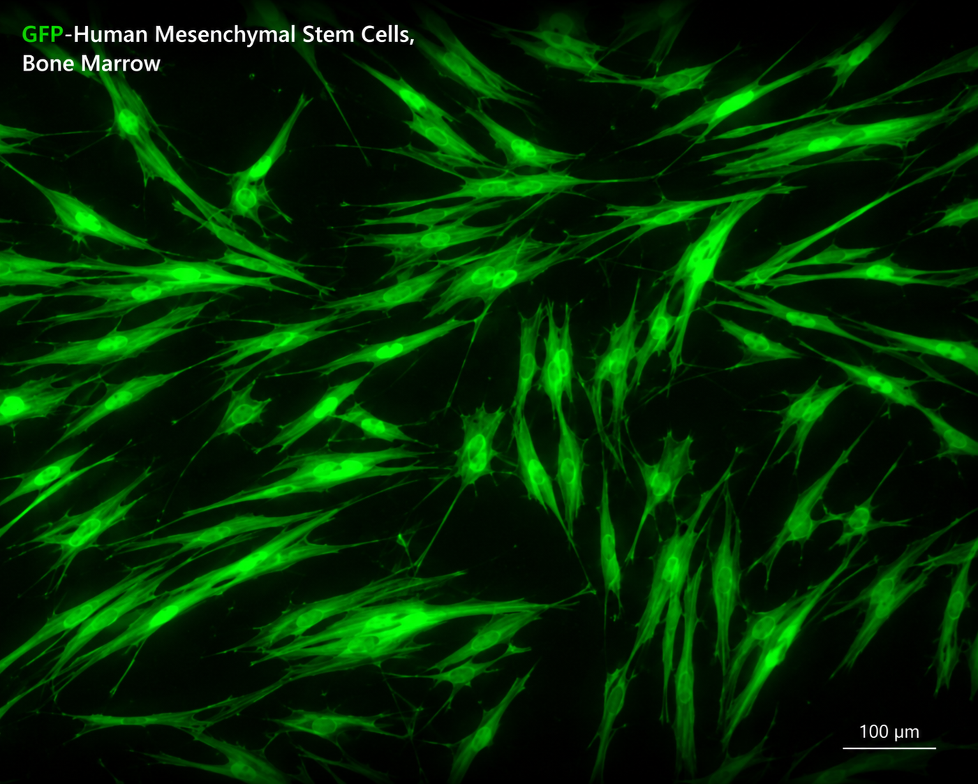 GFP-Human Mesenchymal Stem Cells, Bone Marrow