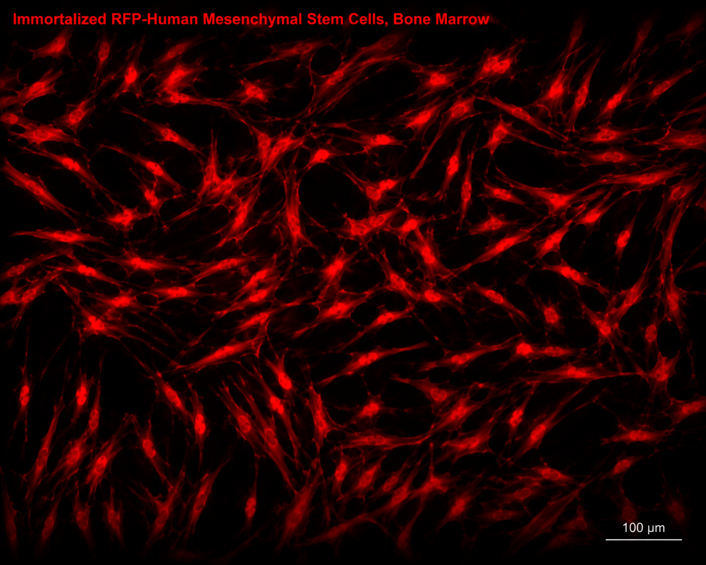 Immortalized RFP-Human Mesenchymal Stem Cells, Bone Marrow