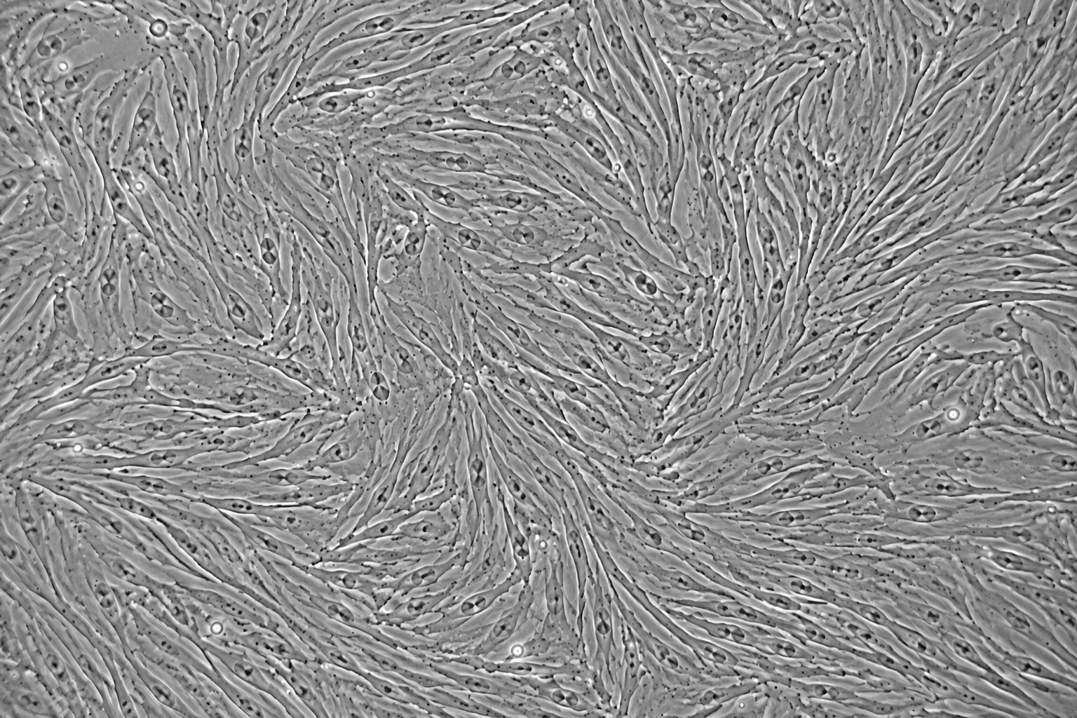 Human Pancreatic Stellate Cells (Cancer-Associated Fibroblasts, CAFs)
