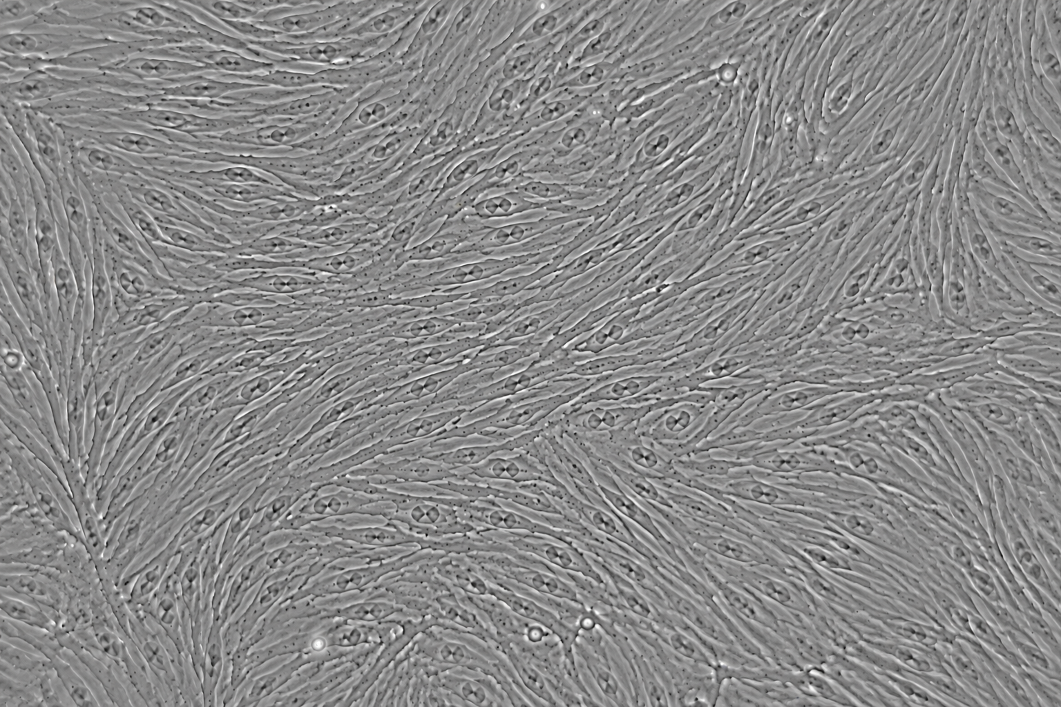 Immortalized Human Kidney CAFs