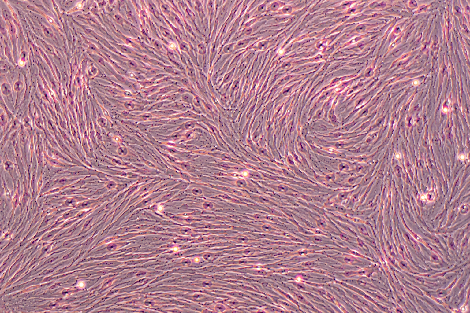Human Ovarian Cancer-Associated Fibroblasts (CAFs)