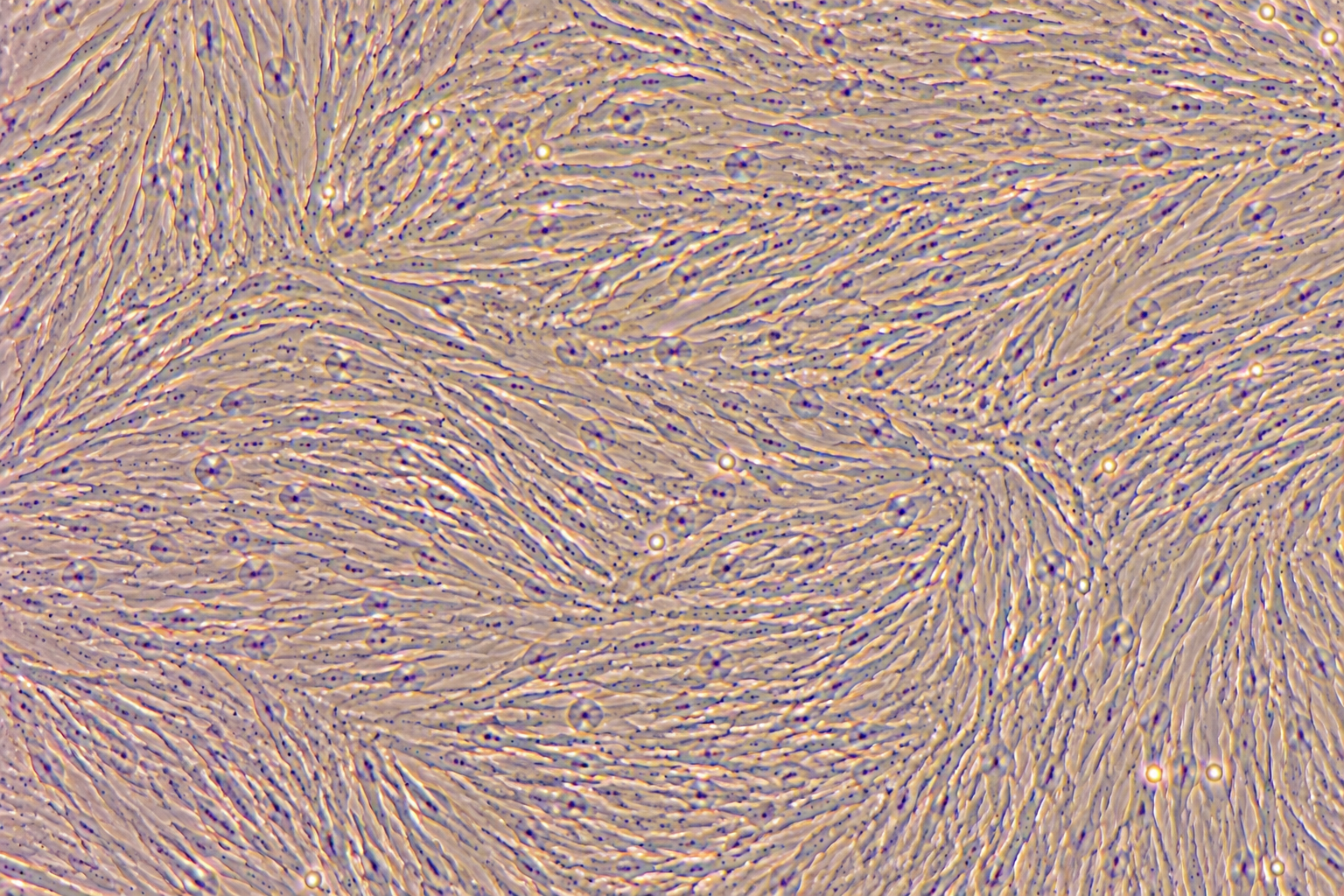 Immortalized Human Ovarian Cancer-Associated Fibroblasts (CAFs)