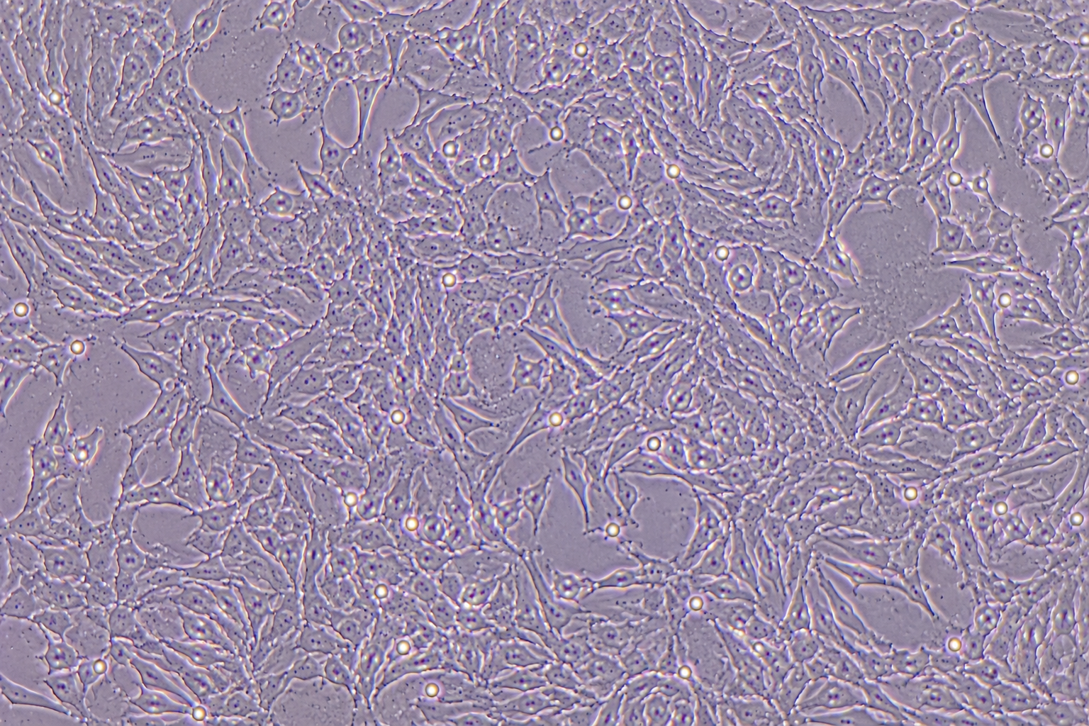 Human Metastatic Ovarian Cancer-Associated Fibroblasts (CAFs)