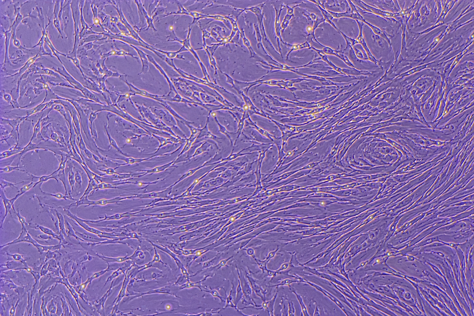 Human Pancreatic CAF – Stellates