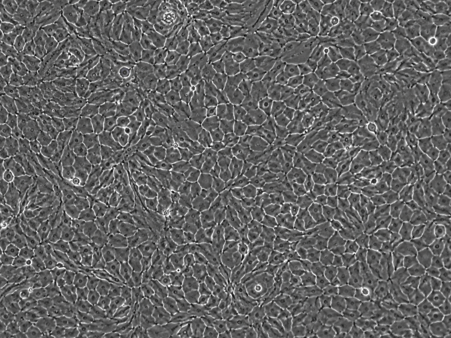 Human Prostate Microvascular Endothelial Cells
