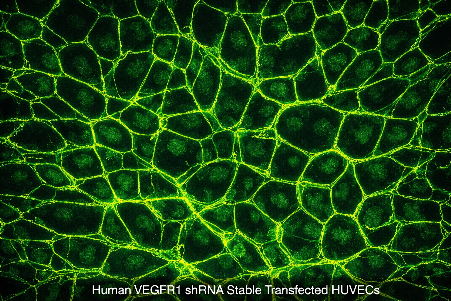 Human VEGFR1 shRNA Stable Transfected HUVECs