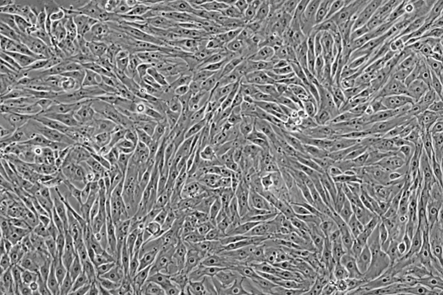 Exosome-GFP Expressing Human Umbilical Vein Endothelial Cells