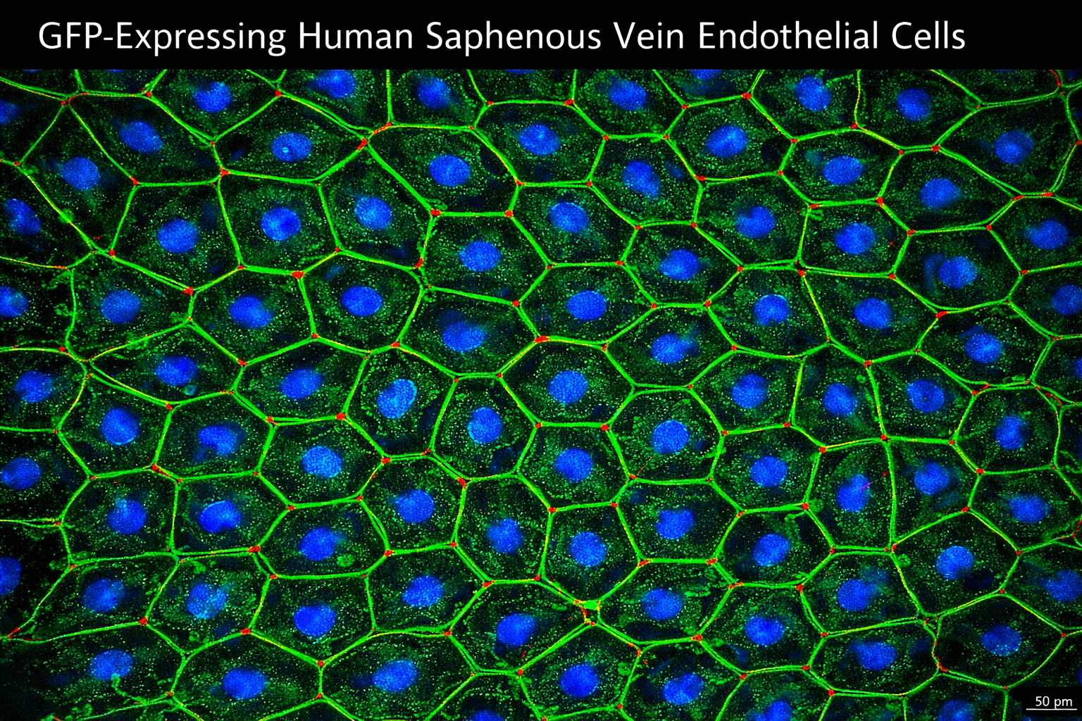 GFP Expressing Human Saphenous Vein Endothelial Cells