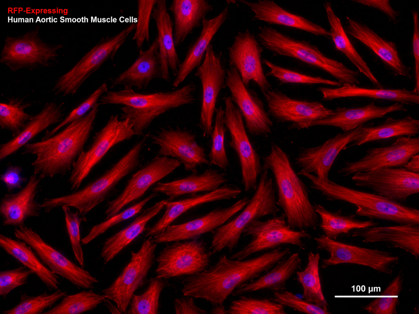 RFP Expressing Human Aortic Smooth Muscle Cells (Adult)