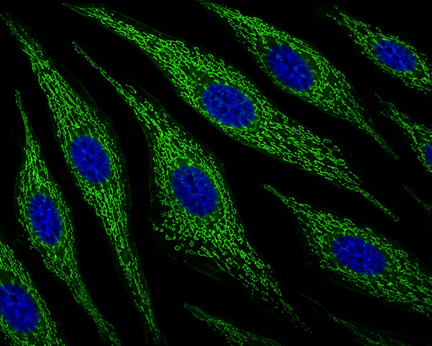 Human Aortic Smooth Muscle Cells (Adult) Expressing GFP-Aequorin in Mitochondria
