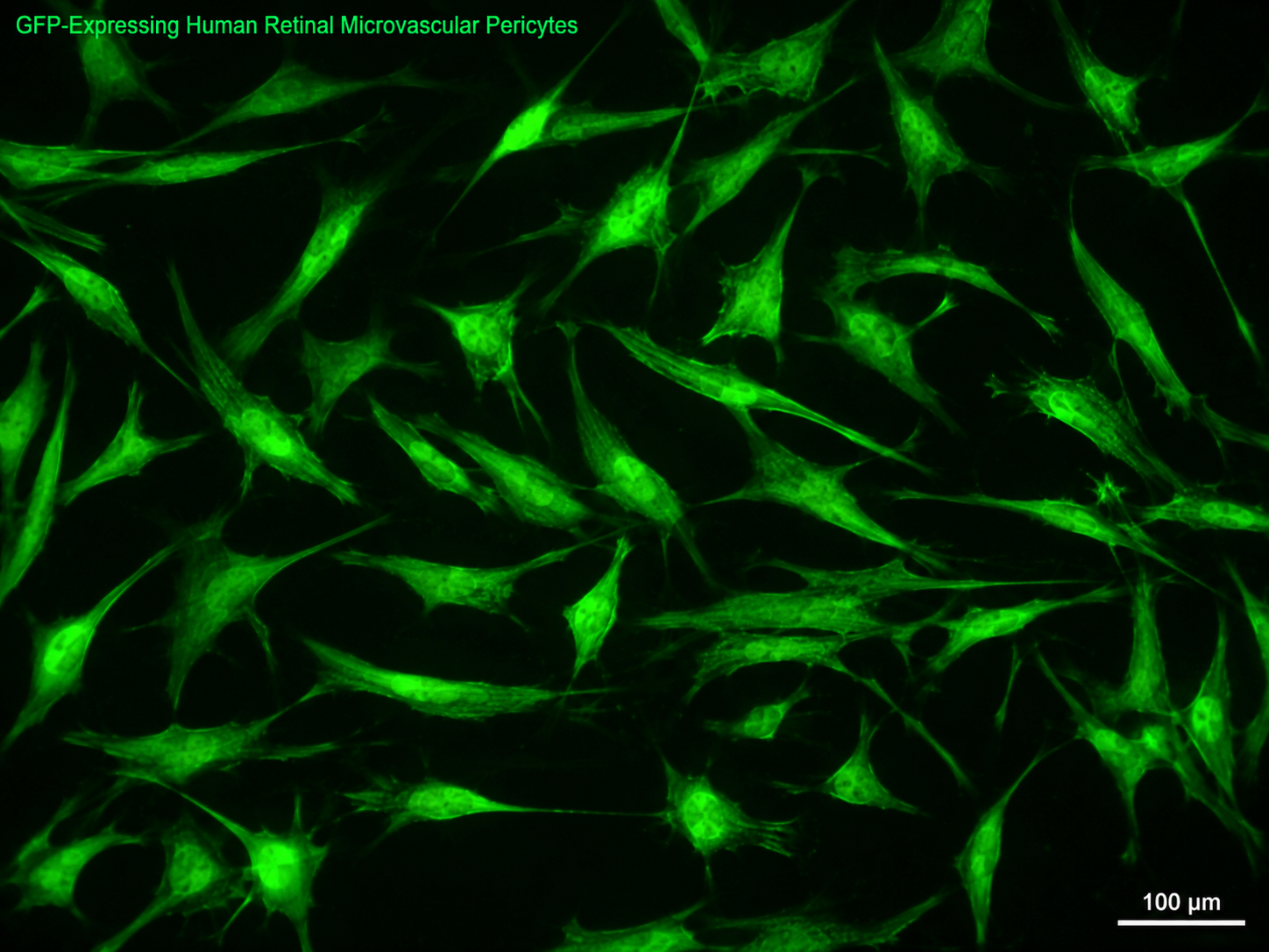 GFP Expressing Human Retinal Microvascular Pericytes