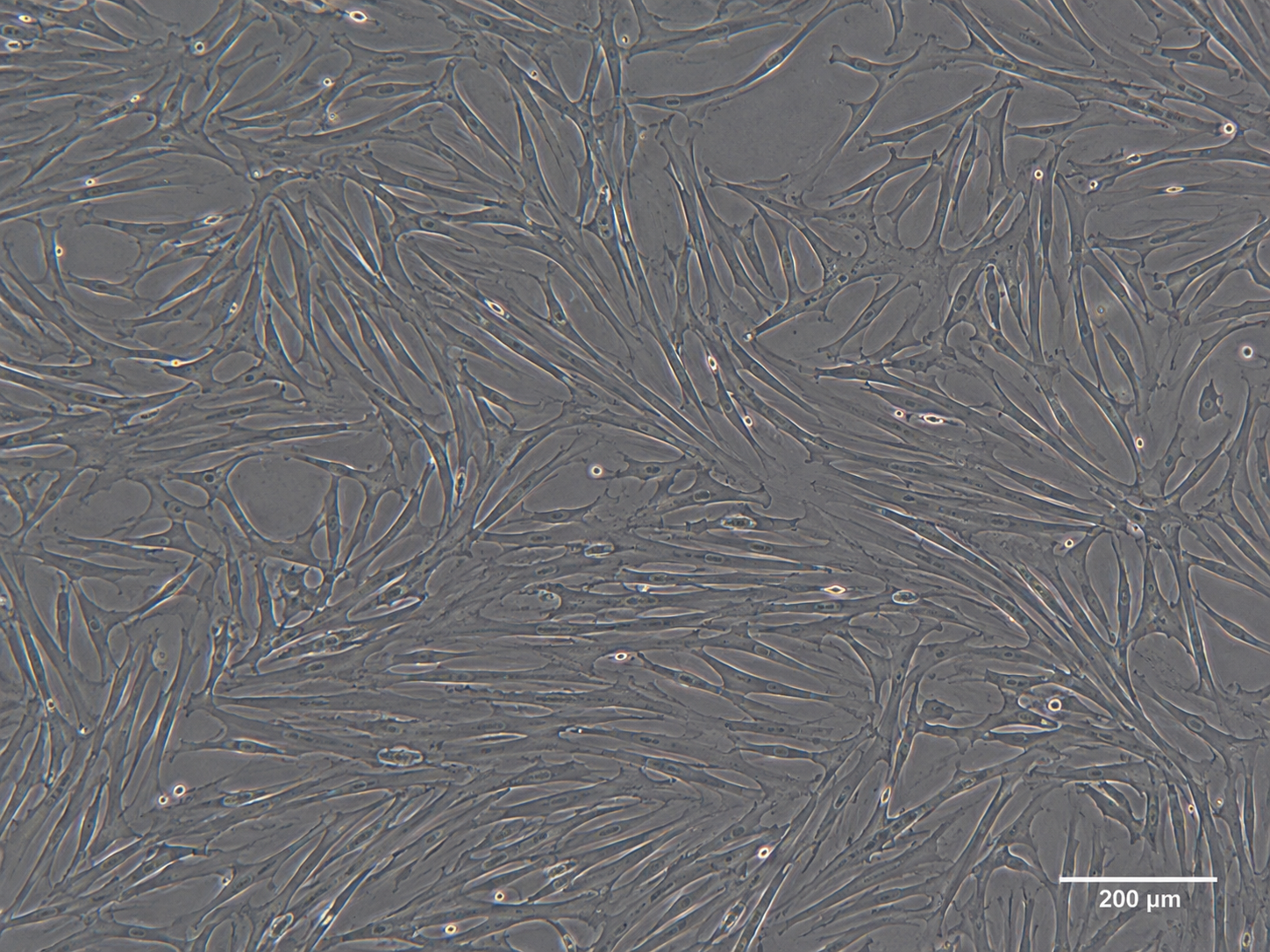 Human Dermal Fibroblasts (Neonatal)