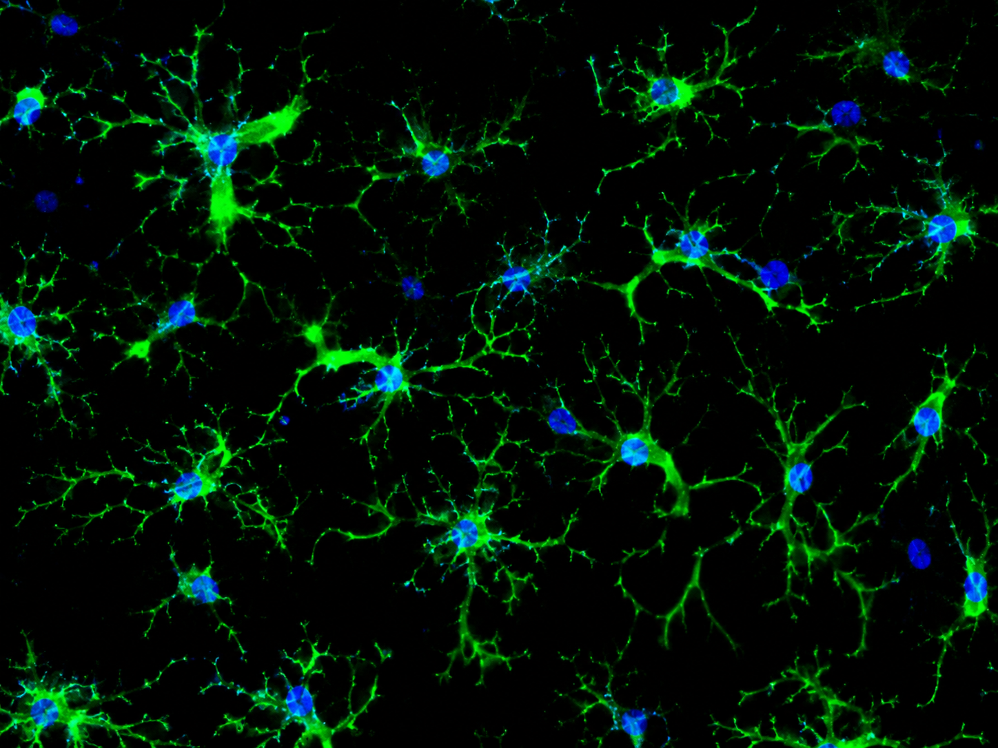 Human Brain Microglia Cells