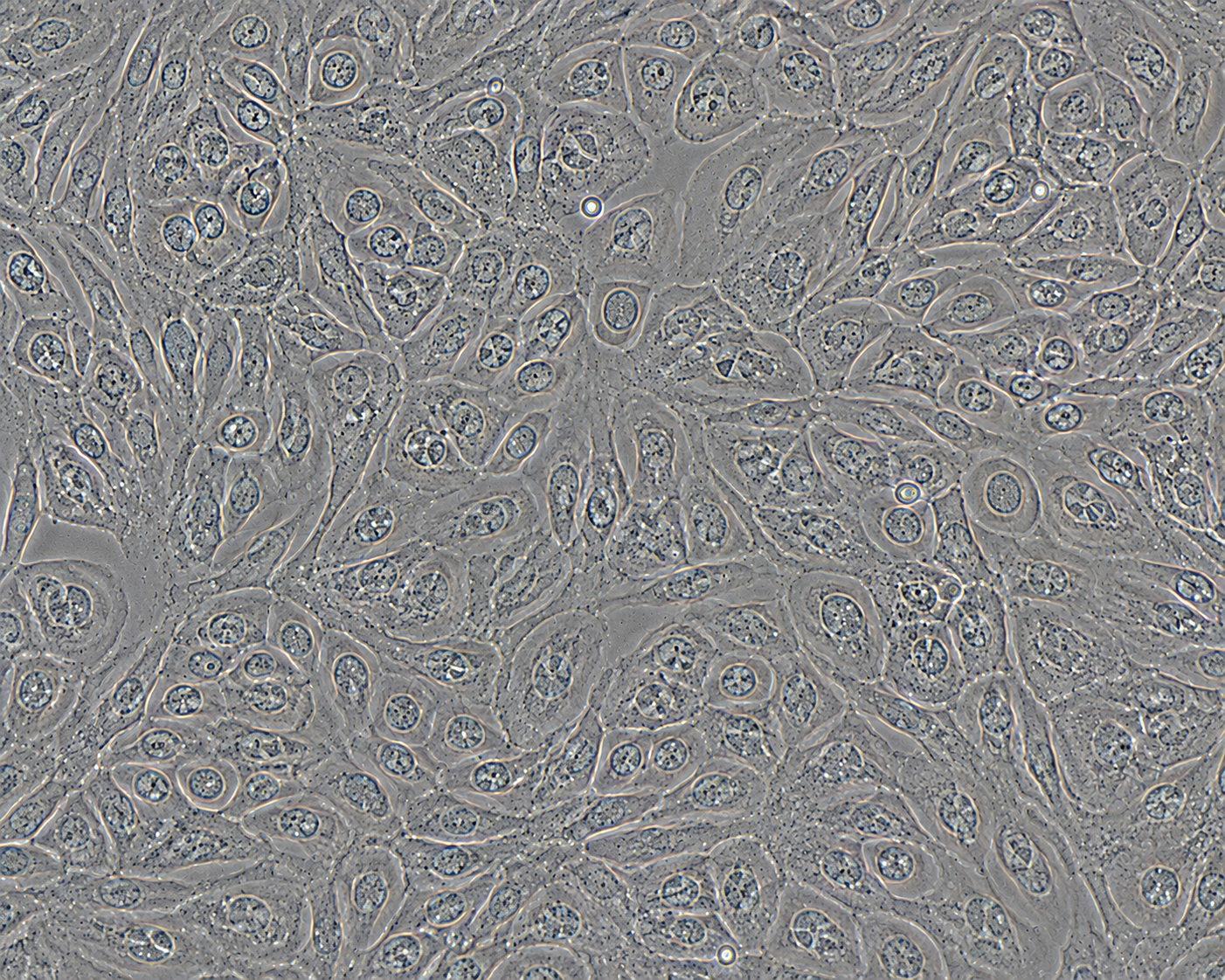 Cre-Expressing Human Primary Bronchial Epithelial Cells