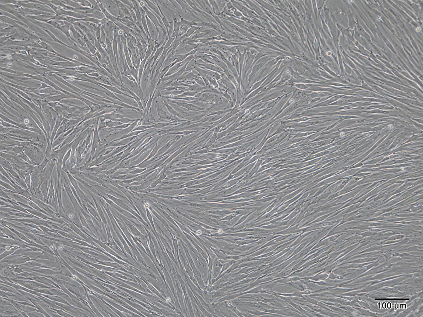 Human Adipose Tissue-Derived Mesenchymal Stem Cells