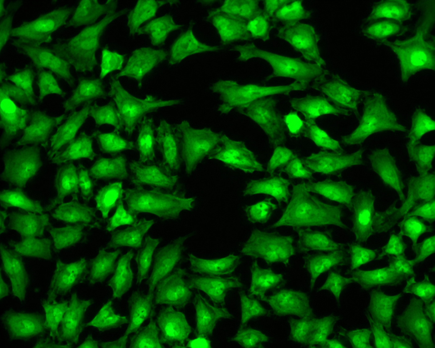 GFP-Human Liver Carcinoma Cells (Hep3B)