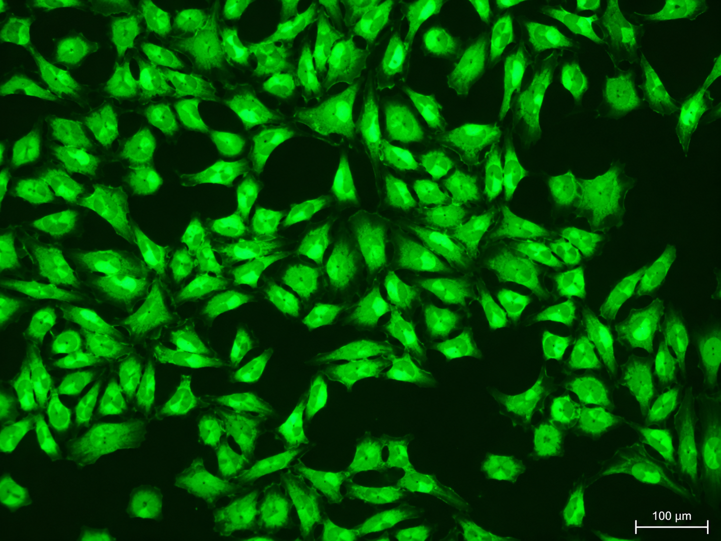 GFP-Human Liver Carcinoma Cells (PLC/PRF5)