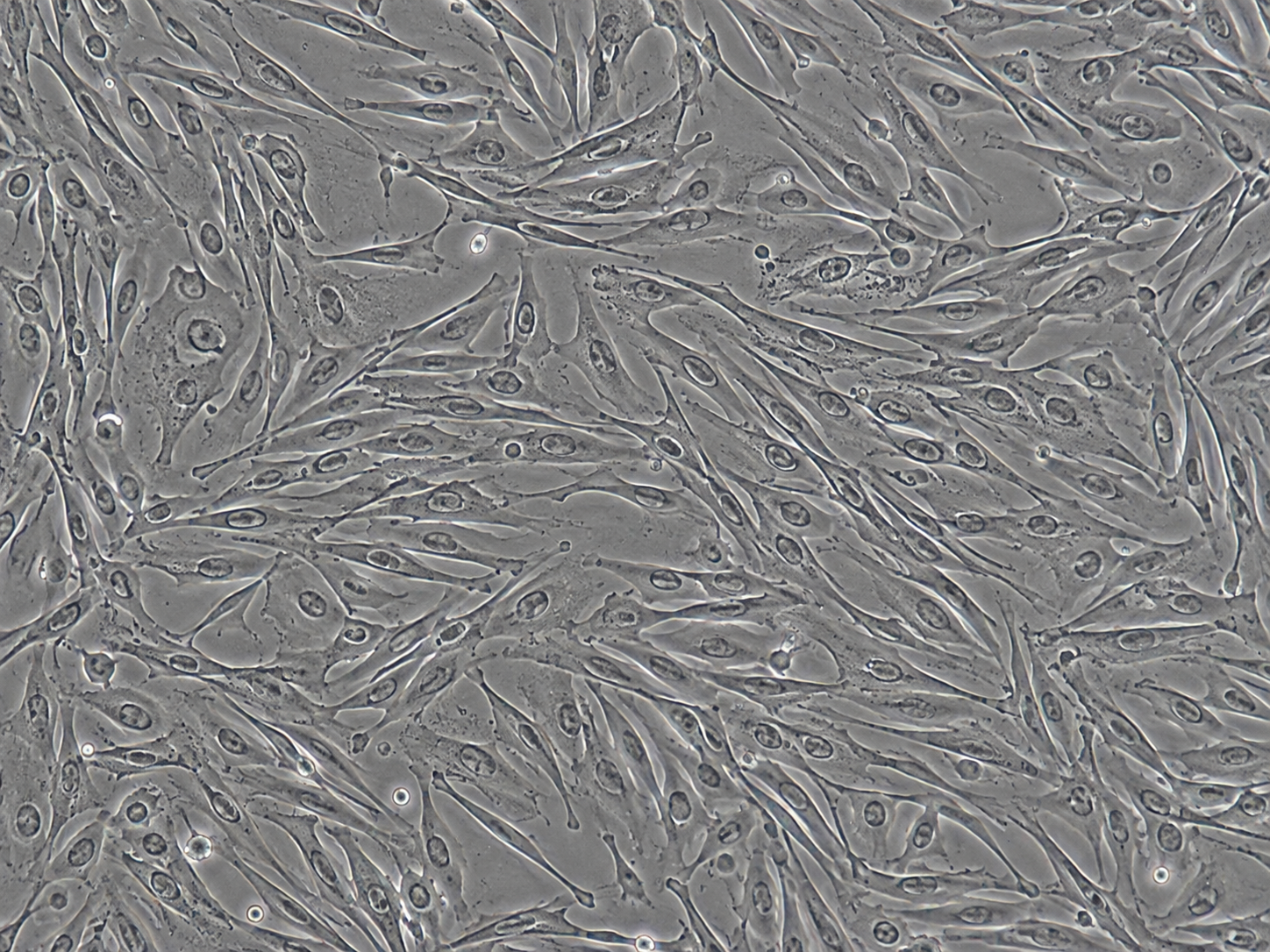 Human Colonic Fibroblasts Cells