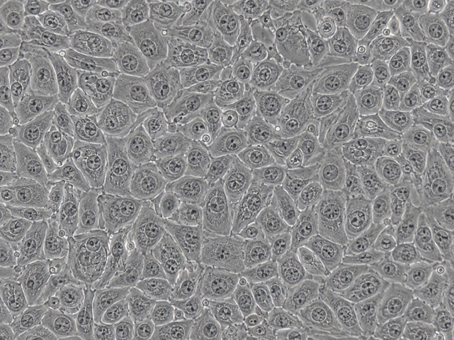Human Colonic Epithelial Cells